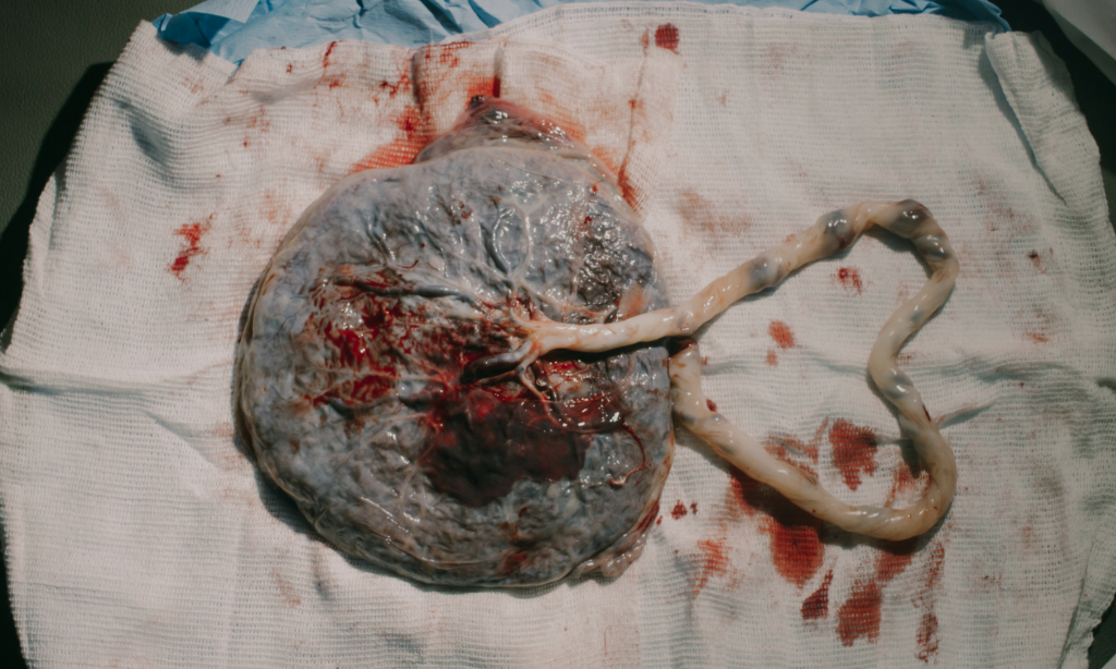 Placenta